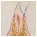 healthy tooth.JPG (6683 bytes) healthy tooth.JPG (6683 bytes)