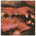 moderate periodontitis mouth.JPG (9659 bytes)